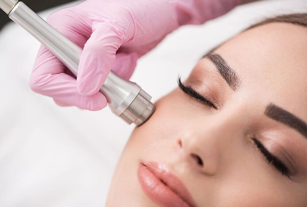 Microdermabrasion