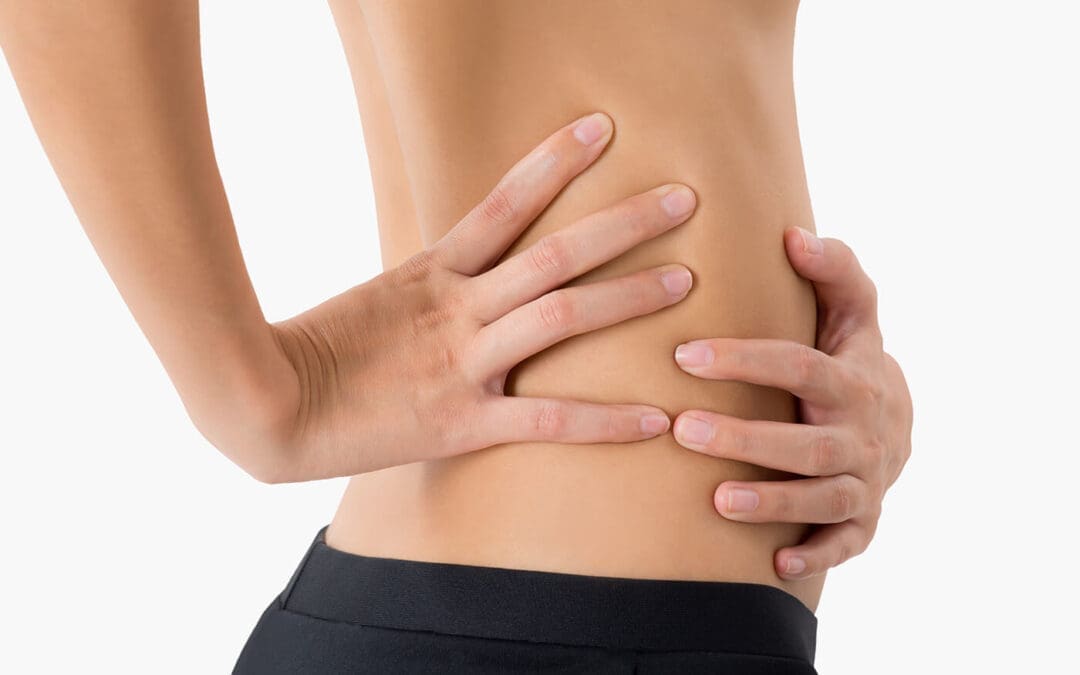 Was ist eine Rektusdiastase?