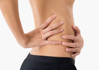 Was ist eine Rektusdiastase?