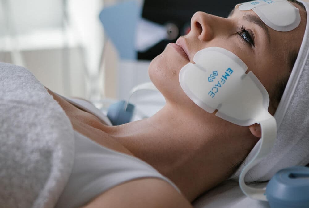 EMFACE bei Volumenverlust: Muskelaufbau statt „Pillowface“