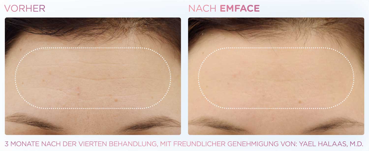 Nachher Bild