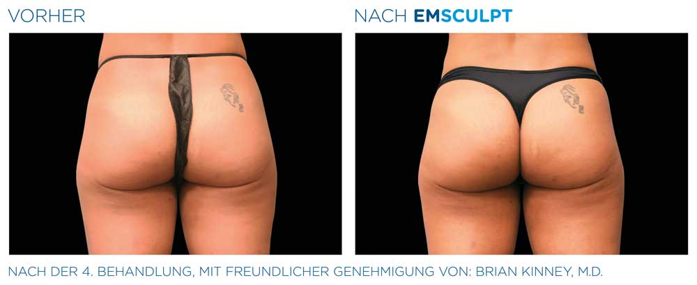 Nachher Bild