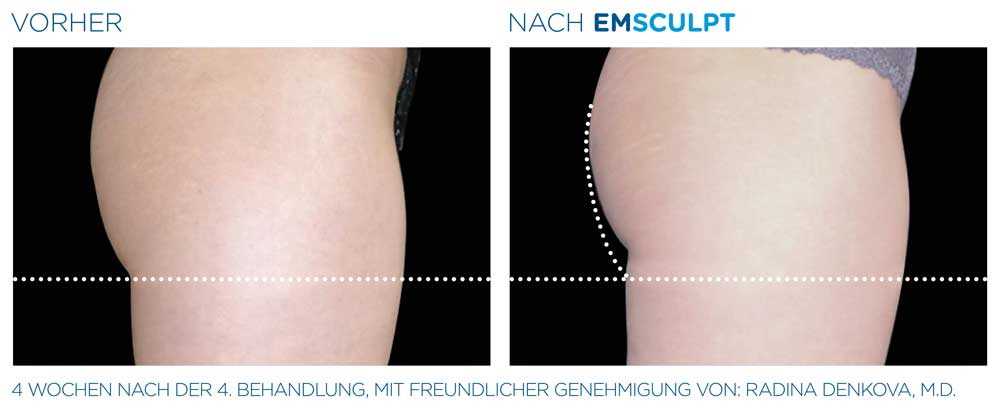 Nachher Bild